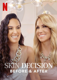 Skin Decision: Before and After saison 1 épisode 8